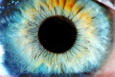 nemici della vista anestetico occhi occhio retina retinite pigmentosa glaucoma